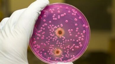 Patologiczne zwolnienie u mężczyzn, gdy są podekscytowani